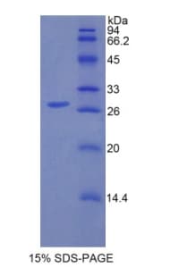 Human IRAK1 / IRAK Protein (Recombinant His)