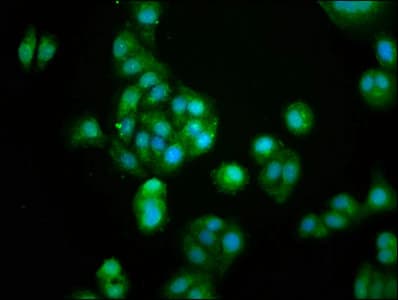 Polyclonal Rabbit anti-Human GUCA2B / Uroguanylin Antibody (aa37-112, IHC)