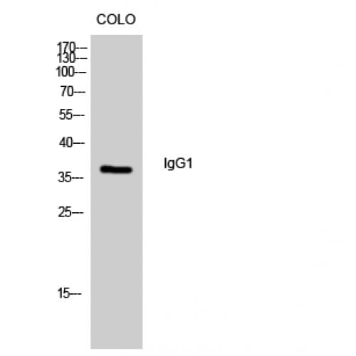 IGHG1 / IgG Antibody (Internal)