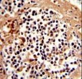 SERPINB7 / MEGSIN Antibody (aa108-137)