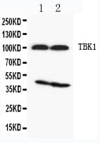 NAK / TBK1 Antibody (aa577-590)