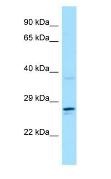 CSF2RA / CD116 Antibody (aa196-245)
