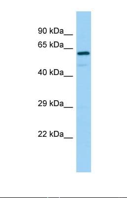 Polyclonal Rabbit anti-Human REPS2 Antibody (aa415-464, WB)