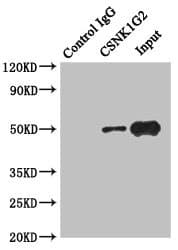 Polyclonal Rabbit anti-Human CSNK1G2 / CKI-Gamma 2 Antibody (IHC, WB)