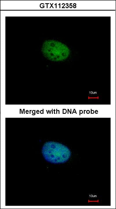 RBPJ Antibody (aa258-500)