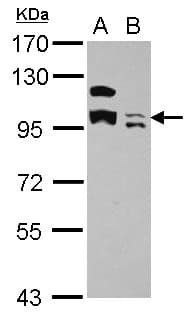 Polyclonal Rabbit anti-Human KCTD19 Antibody (IHC, WB)