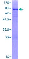 Human CNDP1 Protein (Recombinant GST)