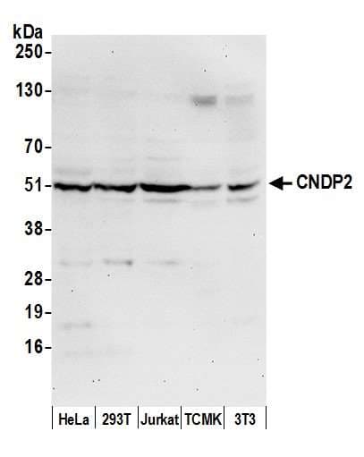 CNDP2 Antibody (aa100-150)
