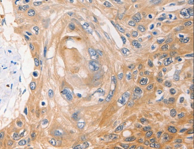 NME1 / NM23 Antibody