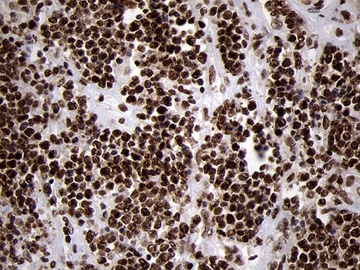 Monoclonal Mouse anti-Human SMC1A / SMC1 Antibody (clone OTI3G4, aa889-1016, IHC, WB)