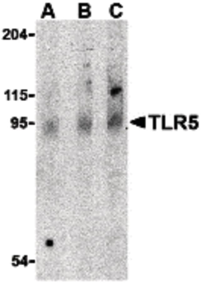 IHC-plus™ Polyclonal Rabbit anti-Human TLR5 Antibody (IHC, WB)