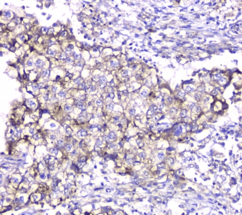 Polyclonal Rabbit anti-Human TIMM17A / TIM17 Antibody (IHC, WB)