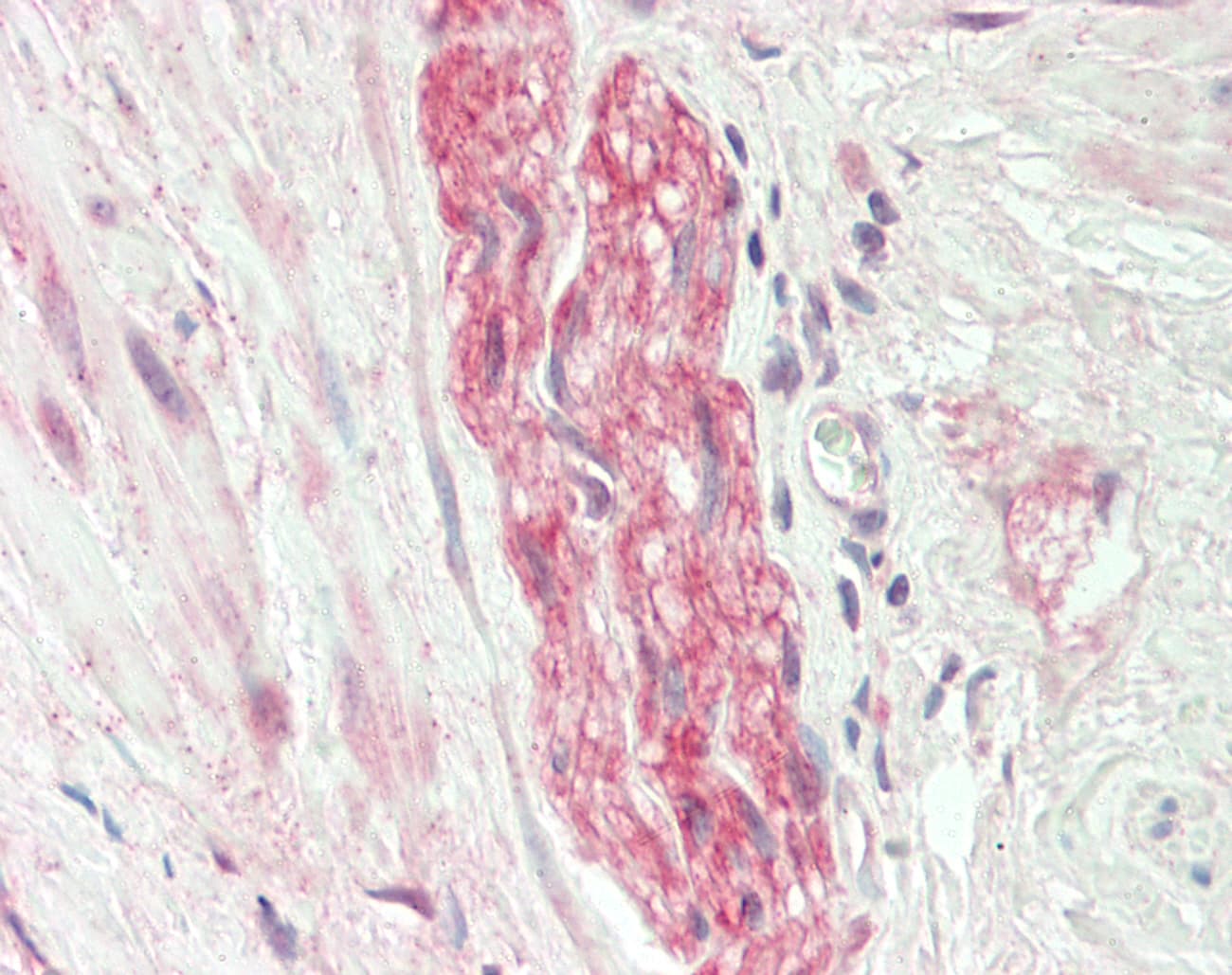 PINK1 Antibody (aa91-140)