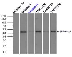 IHC-plus™ Monoclonal Mouse anti-Human SERPINA1 / Alpha 1 Antitrypsin Antibody (clone 9A1, IHC, WB)
