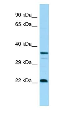 CD83 Antibody (aa103-152)