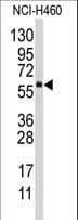 CYP4F12 Antibody (aa473-503)