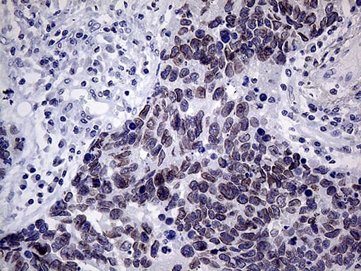 MLH1 Antibody (aa299-527, clone OTI3D1, Carrier-free)