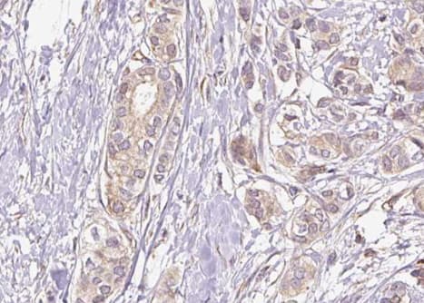 NFKB1 / NF-Kappa-B Antibody (phospho-Ser337)