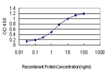 IHC-plus™ CRYM Antibody (clone 6B3)
