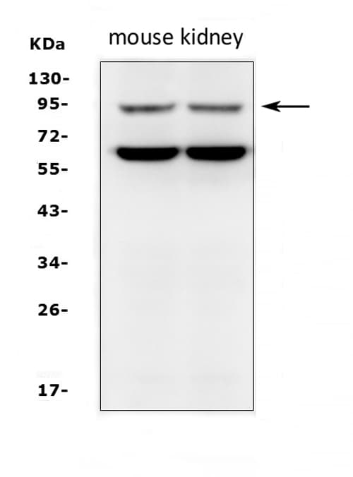 SLC9A2 / NHE2 Antibody (aa666-684)