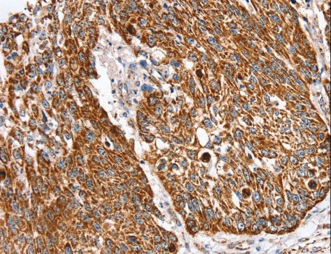 Polyclonal Rabbit anti-Human SSBP1 / mtSSB Antibody (IHC, WB)