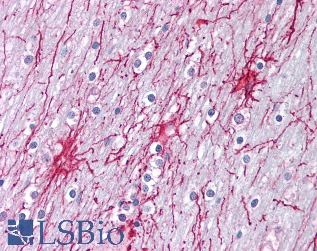 IHC-plus™ XPC Antibody (Preservative Free)