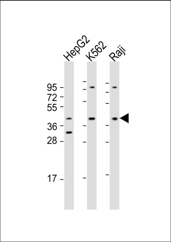 FGFR1OP / FOP Antibody (aa183-214)