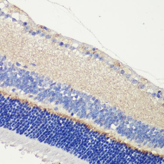 TMEM16B / ANO2 Antibody