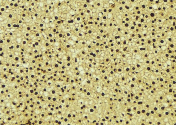 EHMT2 / G9A Antibody
