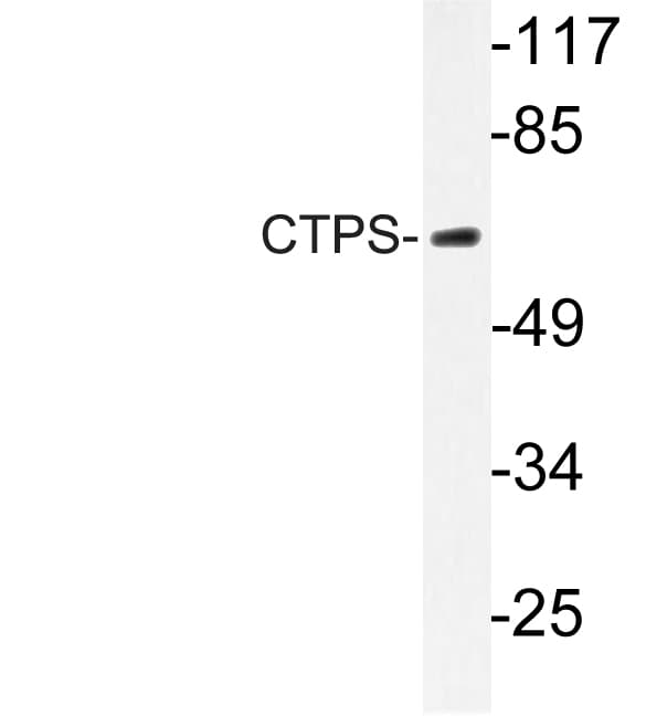 CTPS Antibody (Lys109)