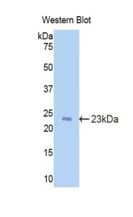 IL-1B / IL-1 Beta Antibody (aa95-262)