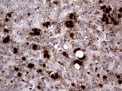 PRTN3 / Myeloblastin Antibody (aa28-248, clone OTI9C2)