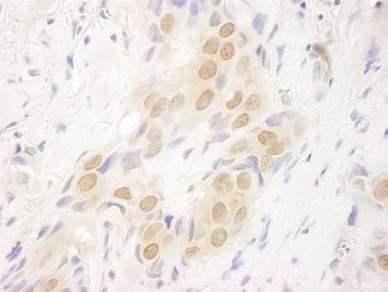 DOT1L / DOT1 Antibody (aa1000-1050)