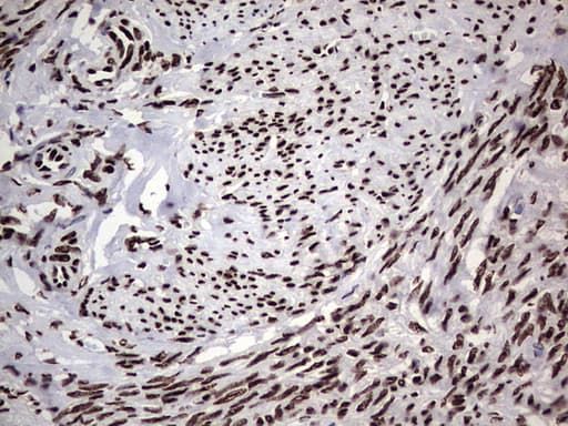 HNRNPL / hnRNP L Antibody (aa270-502, clone OTI9F11)