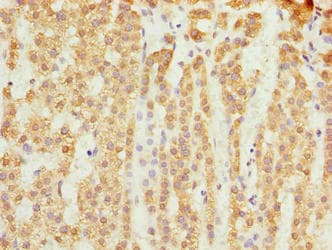 SLC25A18 Antibody
