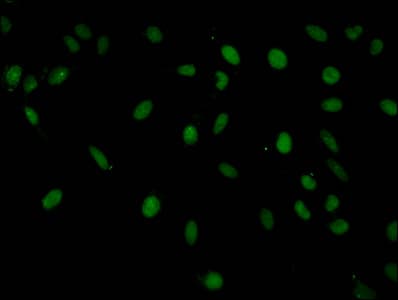 HIST1H1E Antibody