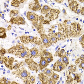 GATM / AGAT Antibody