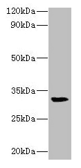 RPSA / Laminin Receptor Antibody