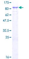 Human RNF220 / C1orf164 Protein (Recombinant GST)
