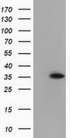ANXA3 / Annexin A3 Antibody (clone OTI8A12)