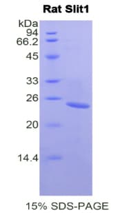 Rat SLIT1 Protein (Recombinant His)