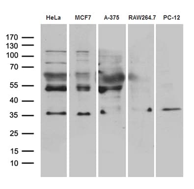 Monoclonal Mouse anti-Human RNF4 Antibody (clone OTI1F6, aa1-190, WB)