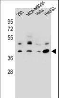 RRAGC / RAGC Antibody (aa169-198)