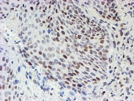 MLF1 Antibody (clone OTI5D9)