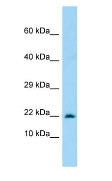 Polyclonal Rabbit anti-Human MARCKSL1 Antibody (C-Terminus, WB)