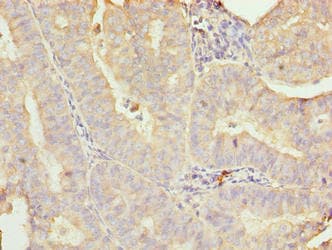 GALNT7 Antibody