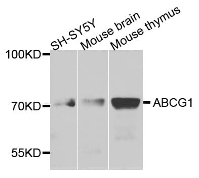 Polyclonal Rabbit anti-Human ABCG1 Antibody (WB)