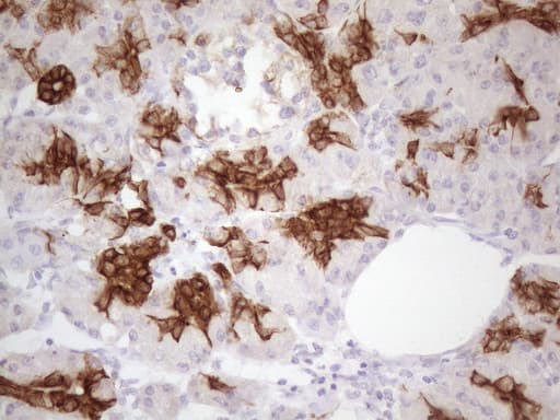 KRT16 / CK16 / Cytokeratin 16 Antibody (clone 7A4, Carrier-free)
