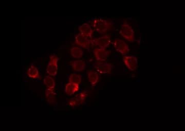 ACAD11 Antibody