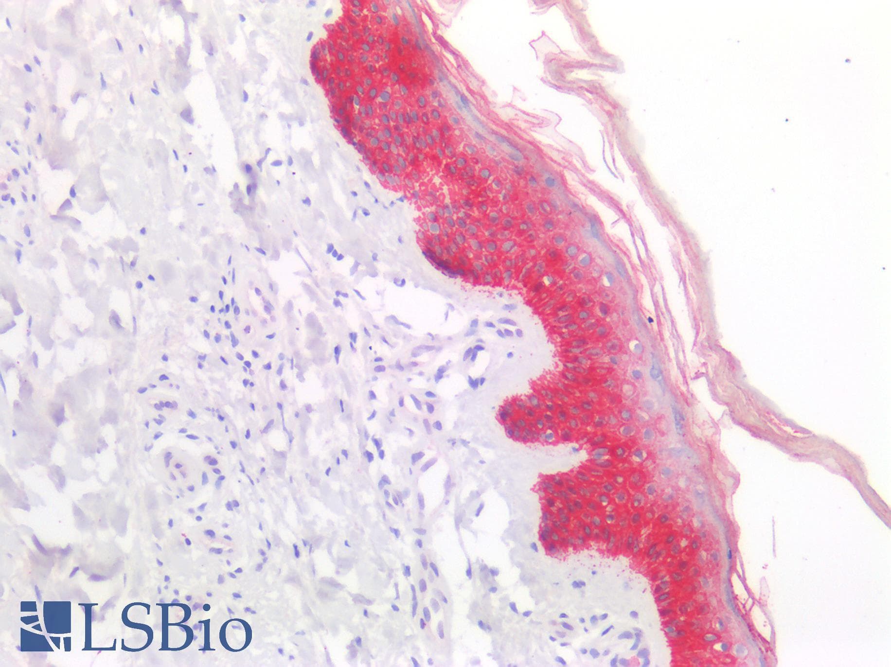 PathPlus™ KRT5 / CK5 / Cytokeratin 5 Antibody